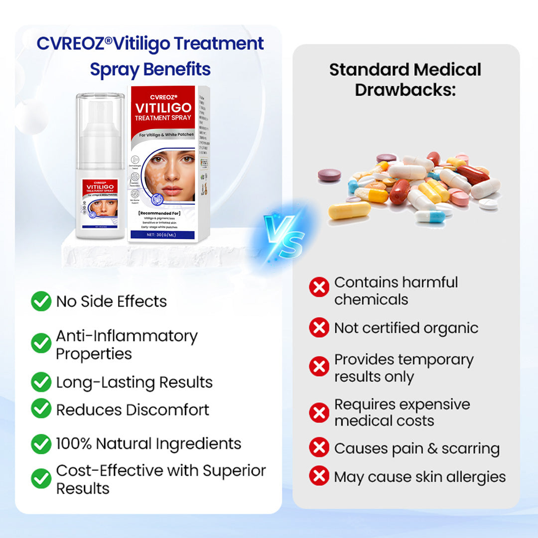 Cvreoz® Vitiligo Treatment Spray