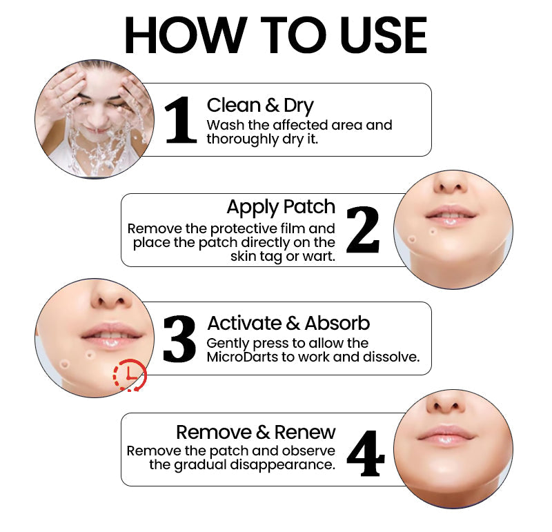 OFFICIAL KUBOZN® Pro MicroDarts TAG'Gone Patch