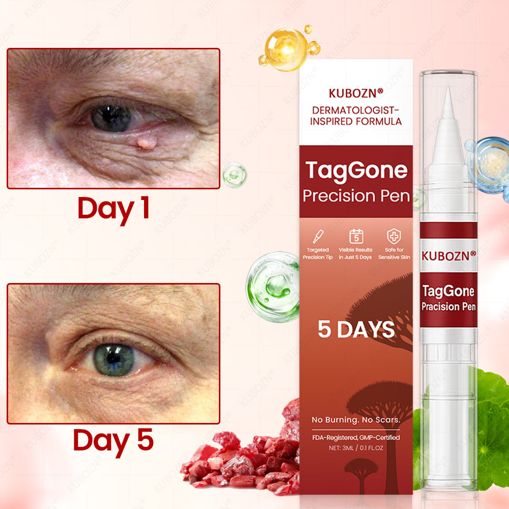 ✨KUBOZN® TagGone Precision Pen (2025 Upgrade) | Skin Tag, Mole & Wart Remover – Fast, Gentle & Scar-Free in 5 Days