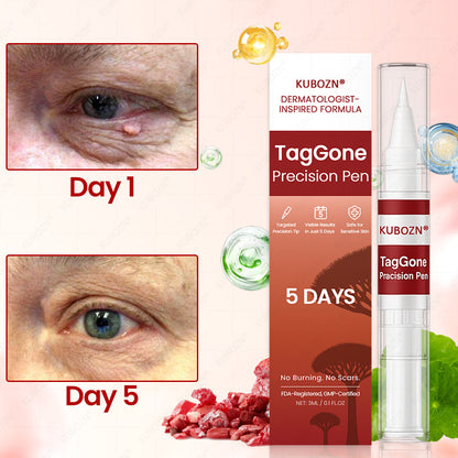 ✨KUBOZN® TagGone Precision Pen (2025 Upgrade) | Skin Tag, Mole & Wart Remover – Fast, Gentle & Scar-Free in 5 Days
